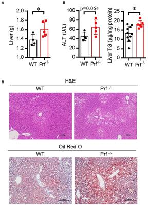 Perforin Acts as an Immune Regulator to Prevent the Progression of NAFLD